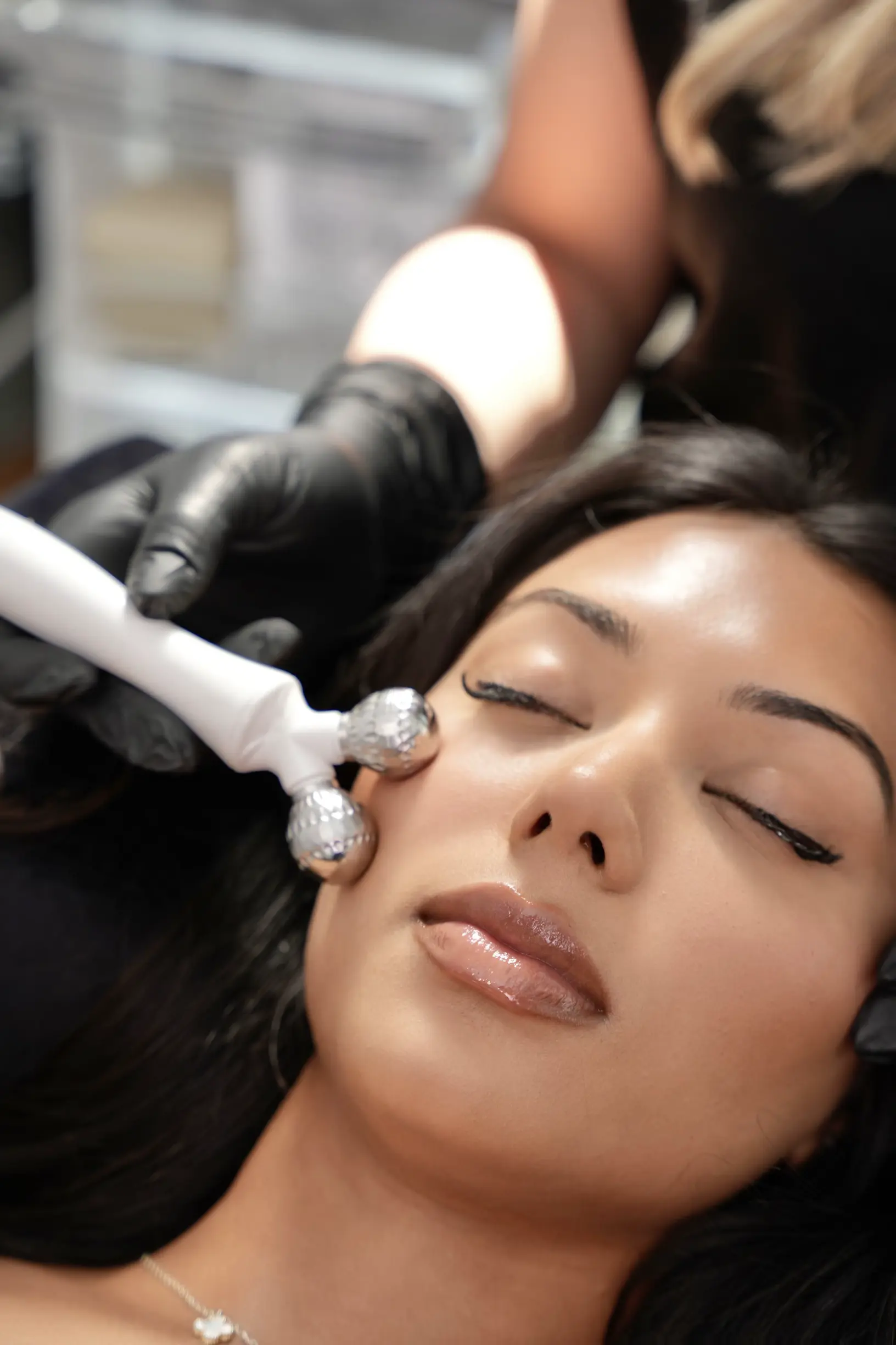 microdermabrasion facial