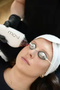 skin resurfacing