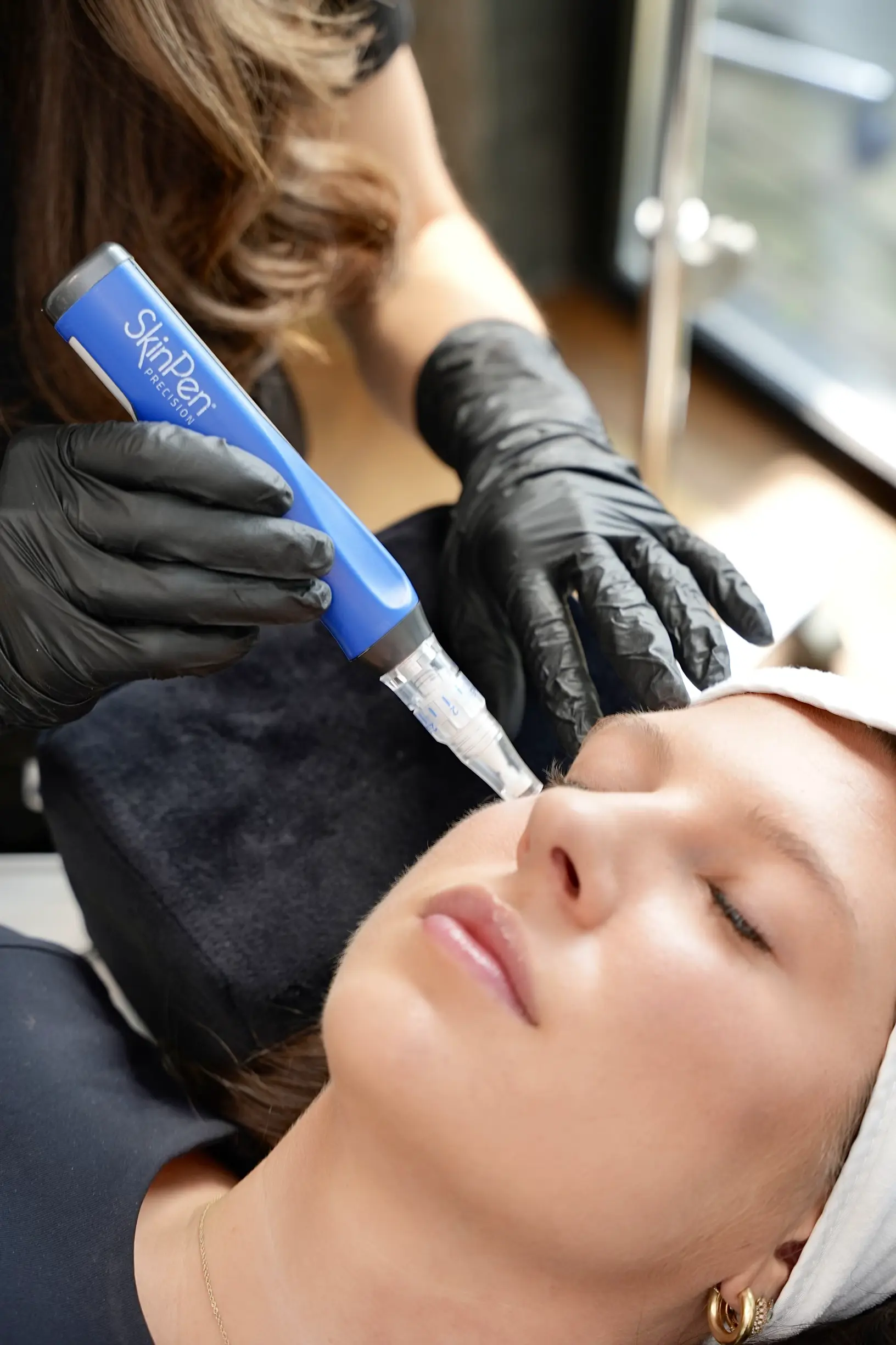 skinpen microneedling